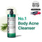 Miracle Back Acne Cleanse - AHA BHA PHA